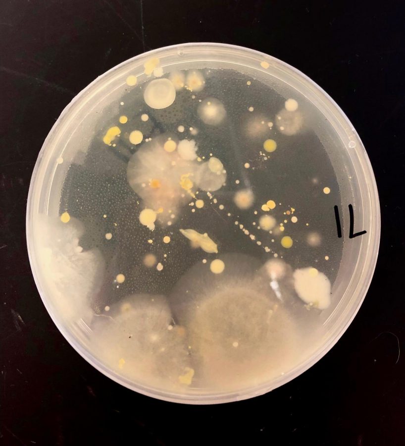 Pictured above is the Petri dish one weekend after Tidball and Hartford swabbed the keyboard. Some colonies have been identified as pink yeast and staphylococcus.